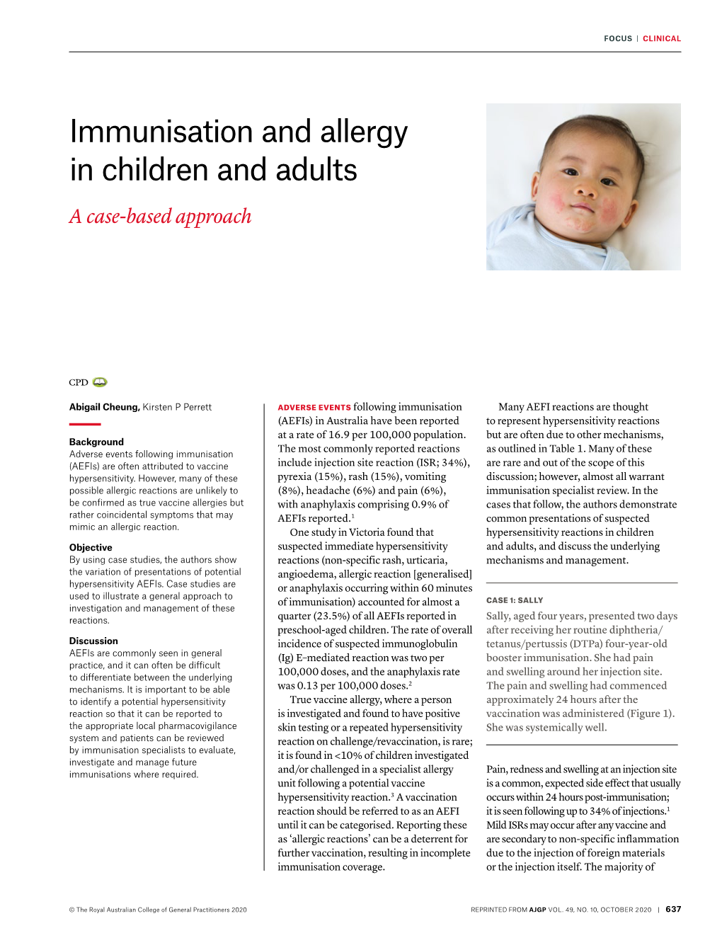 Immunisation and Allergy in Children and Adults