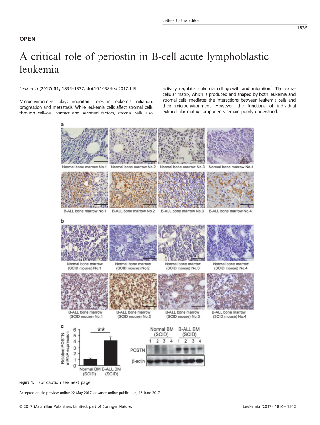 A Critical Role of Periostin in B-Cell Acute Lymphoblastic Leukemia