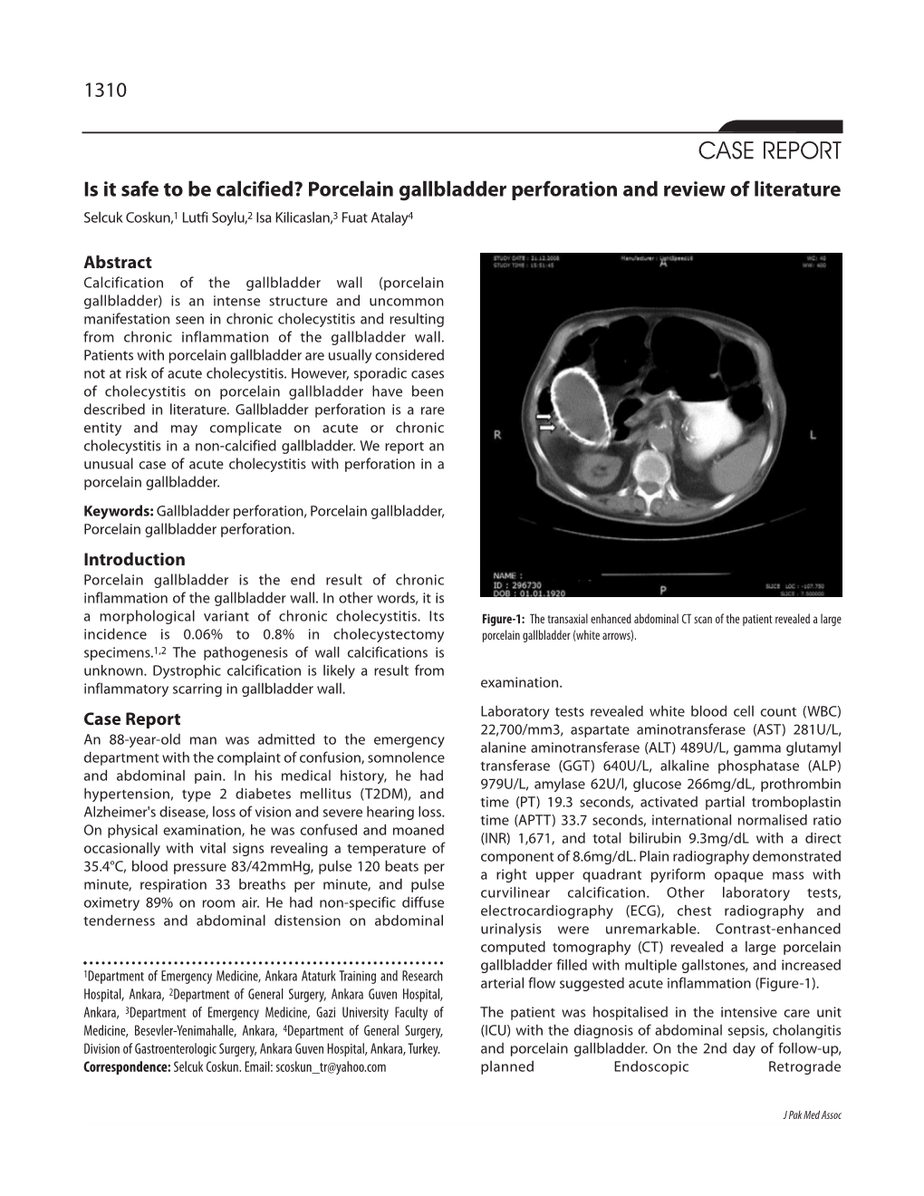 CASE REPORT Is It Safe to Be Calcified? Porcelain Gallbladder Perforation and Review of Literature Selcuk Coskun,1 Lutfi Soylu,2 Isa Kilicaslan,3 Fuat Atalay4