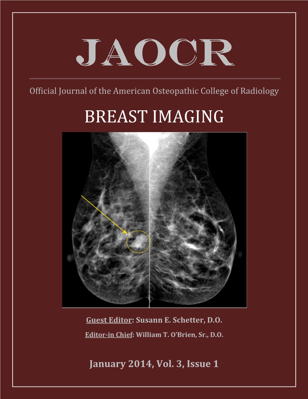 Breast Imaging