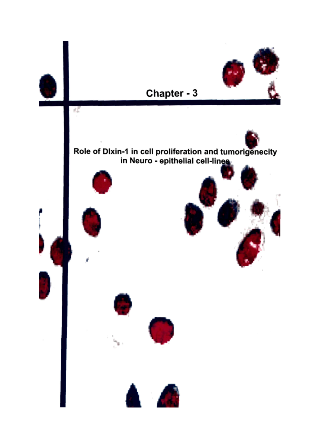 Role of Dlxin-1 in Cell Proliferation and Tumorigenecity in Neuro