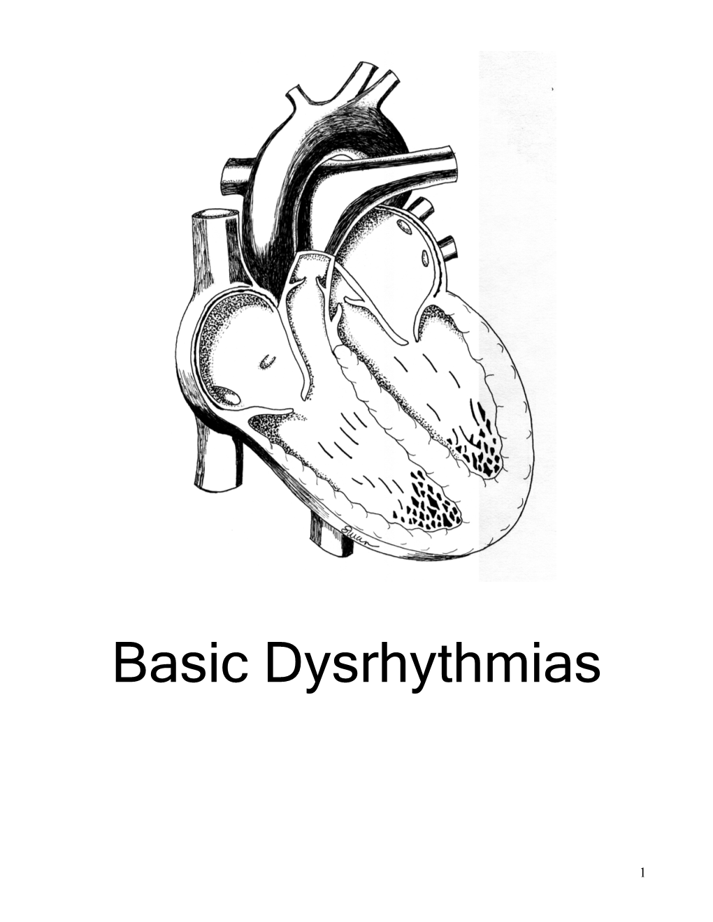 Basic Dysrhythmias