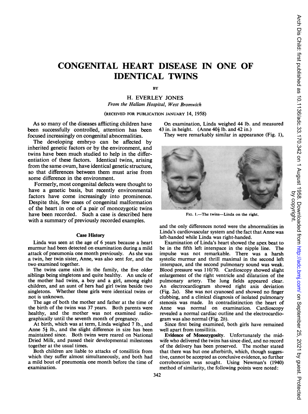 Congenital Heart Disease in One of Identical Twins