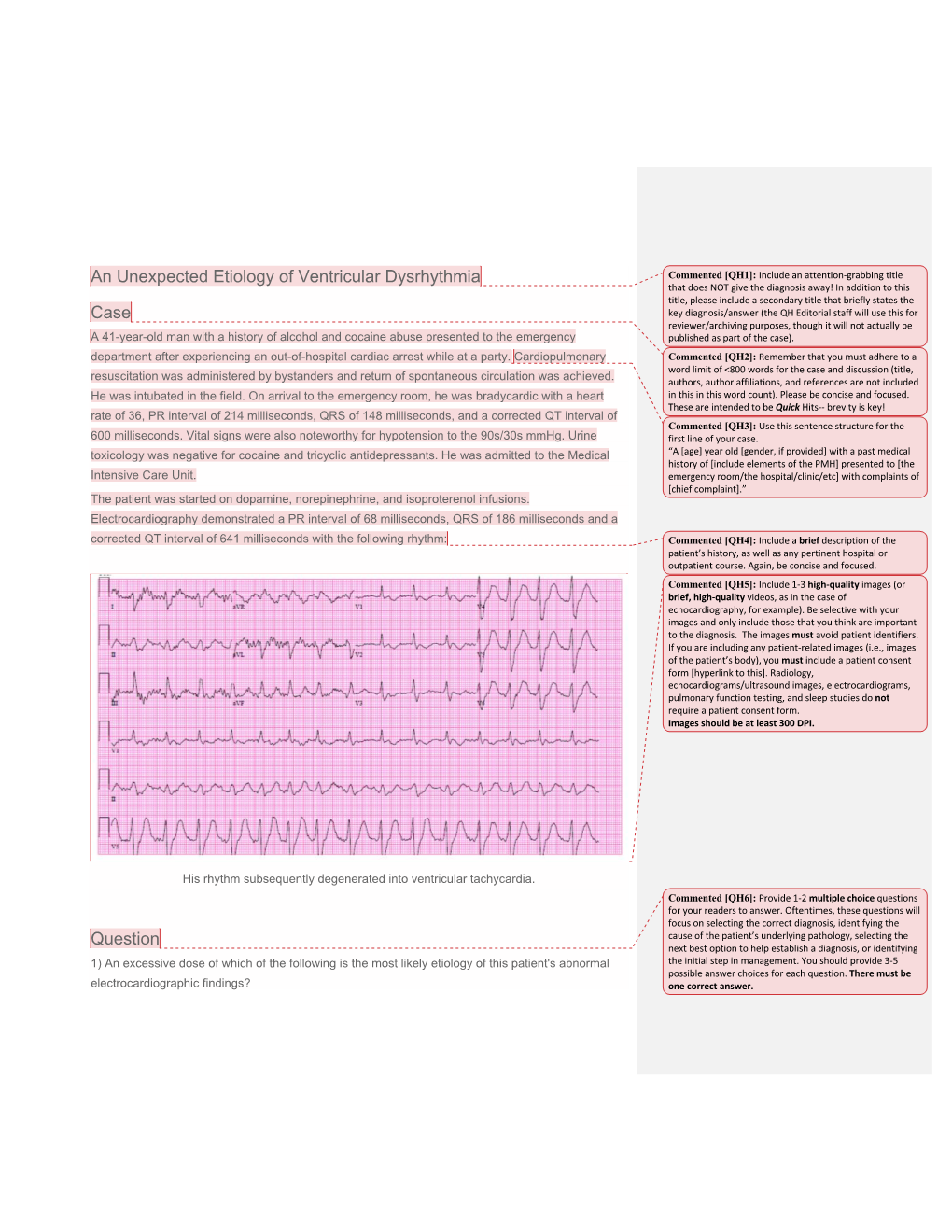 An Unexpected Etiology of Ventricular Dysrhythmia Case Question