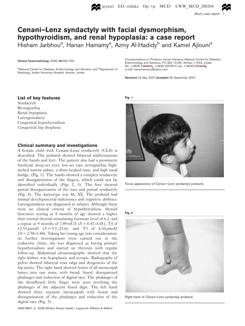 Cenani–Lenz Syndactyly with Facial Dysmorphism, Hypothyroidism, and Renal Hypoplasia: a Case Report Hisham Jarbhoua, Hanan Hamamya, Azmy Al-Hadidyb and Kamel Ajlounia