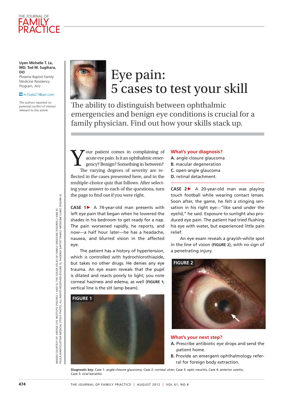 Eye Pain: 5 Cases to Test Your Skill