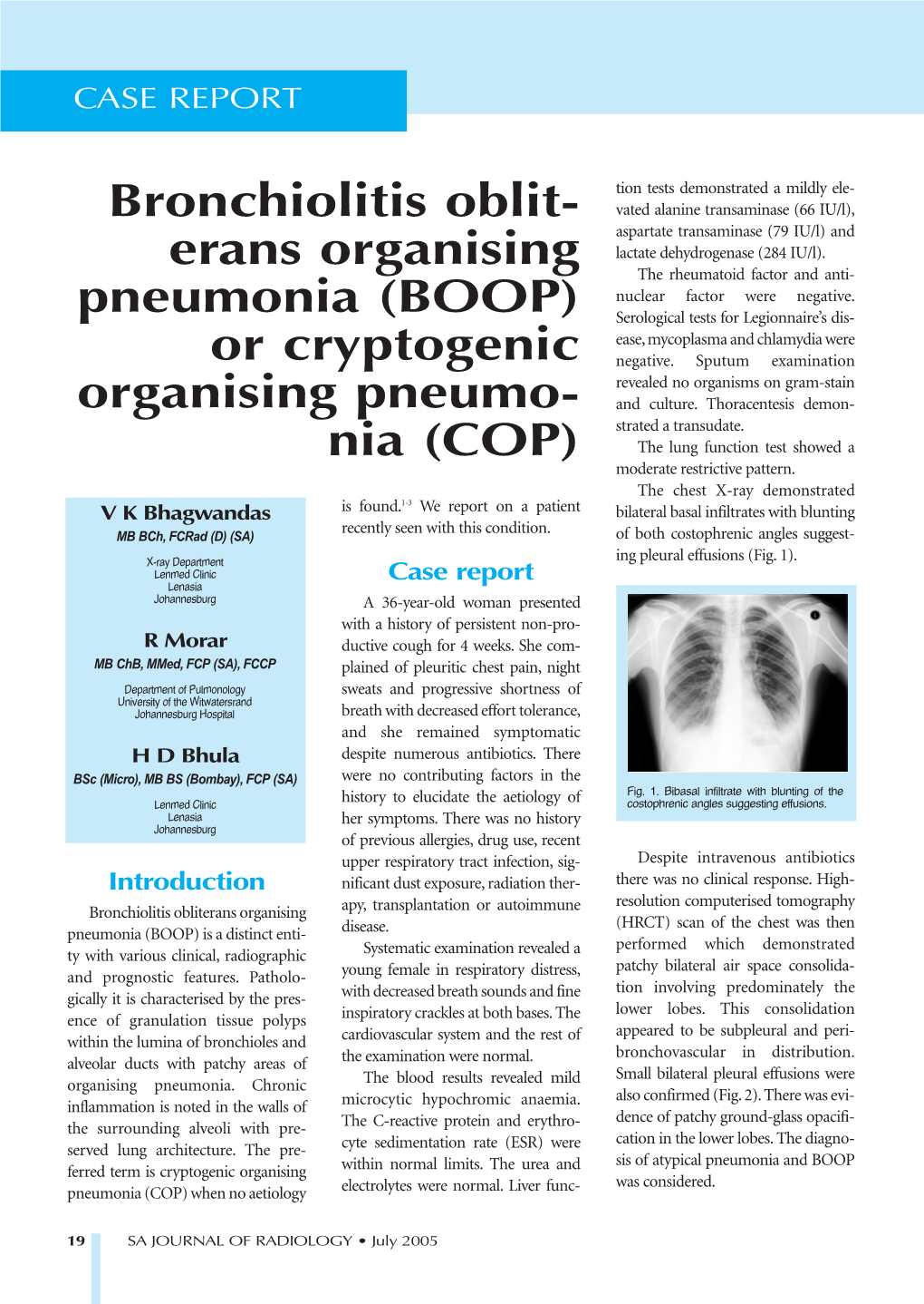 Bronchiolitis Oblit- Erans Organising Pneumonia (BOOP) Or Cryptogenic