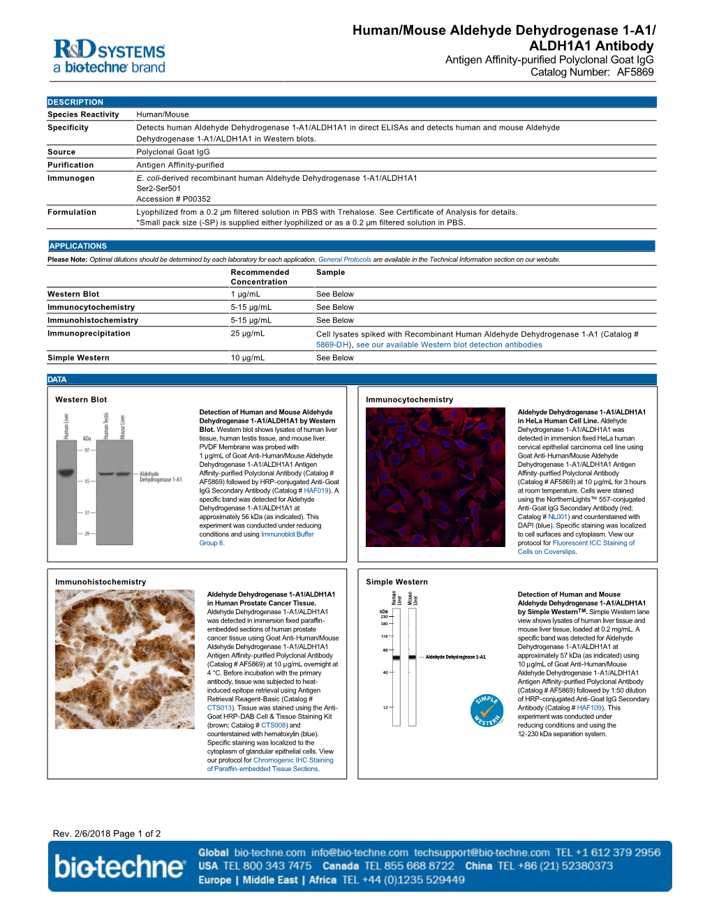 Human/Mouse Aldehyde Dehydrogenase 1-A1/ ALDH1A1 Antibody Antigen Affinity-Purified Polyclonal Goat Igg Catalog Number: AF5869