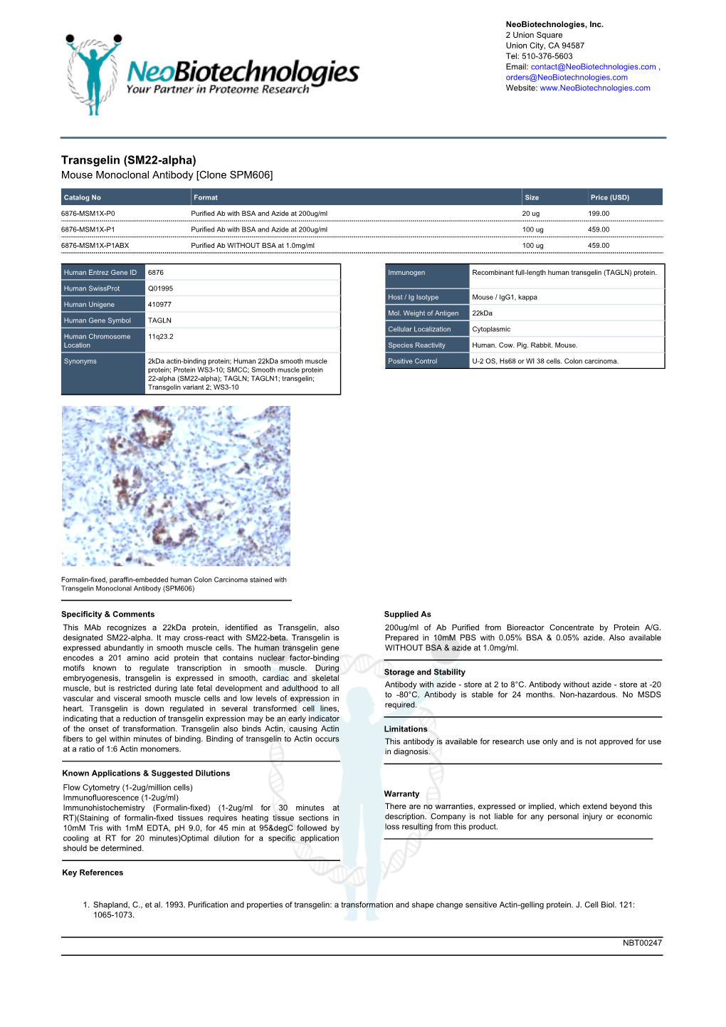 Transgelin (SM22-Alpha) Mouse Monoclonal Antibody [Clone SPM606]