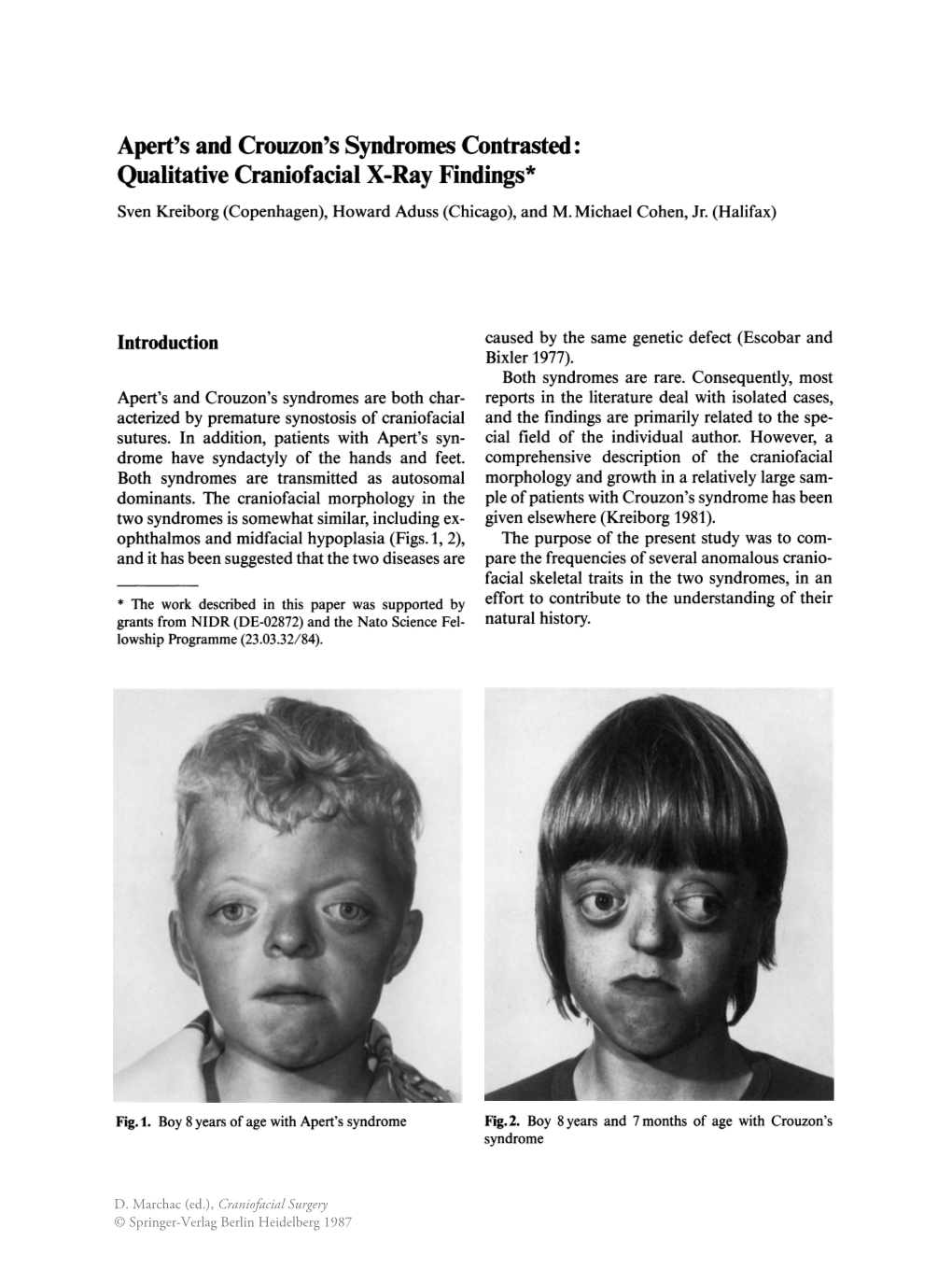 Apert's and Crouzon's Syndromes Contrasted: Qualitative Craniofacial X-Ray Findings* Sven Kreiborg (Copenhagen), Howard Aduss (Chicago), and M.Michael Cohen, Jr