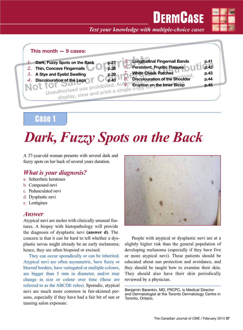 Dark, Fuzzy Spots on the Back P.37 5