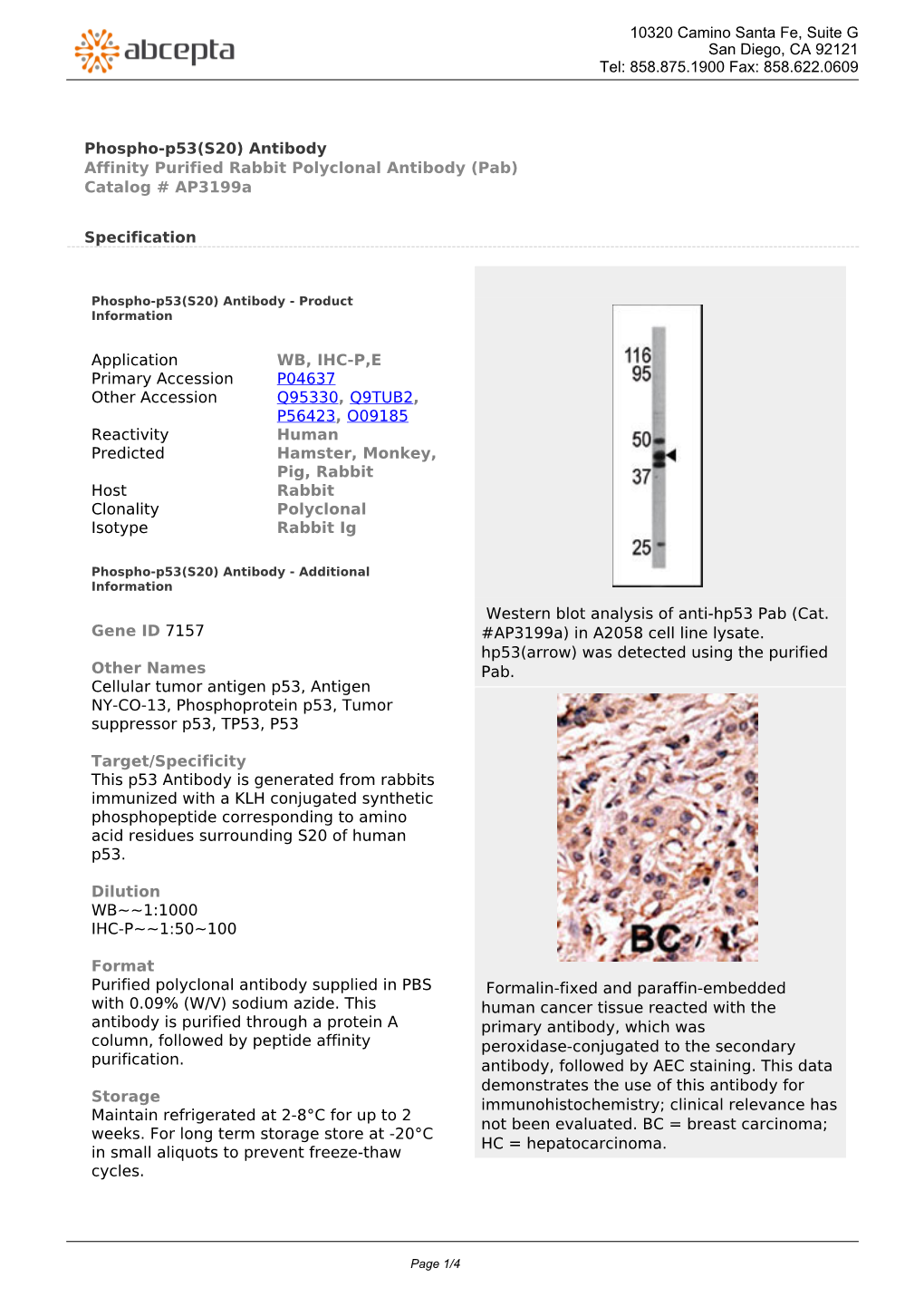 Phospho-P53(S20) Antibody Affinity Purified Rabbit Polyclonal Antibody (Pab) Catalog # Ap3199a