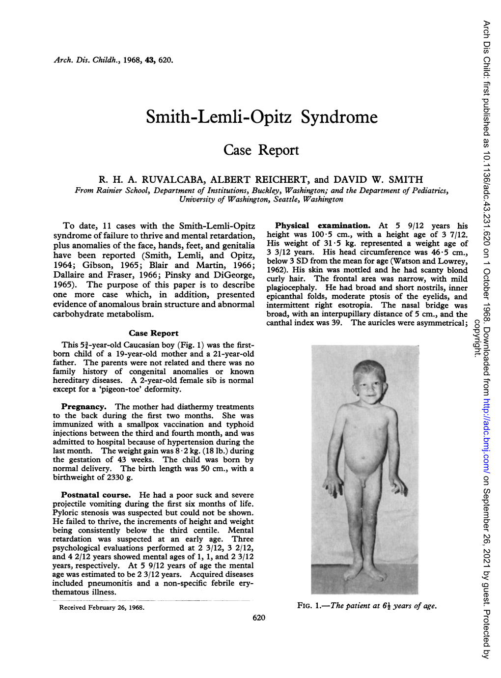 Smith-Lemli-Opitz Syndrome Case Report