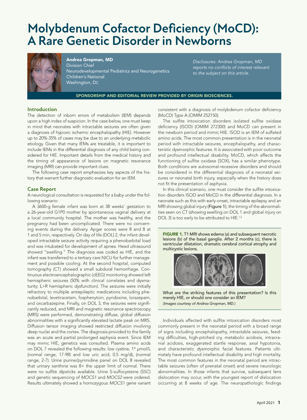 Molybdenum Cofactor Deficiency (Mocd): a Rare Genetic Disorder in Newborns