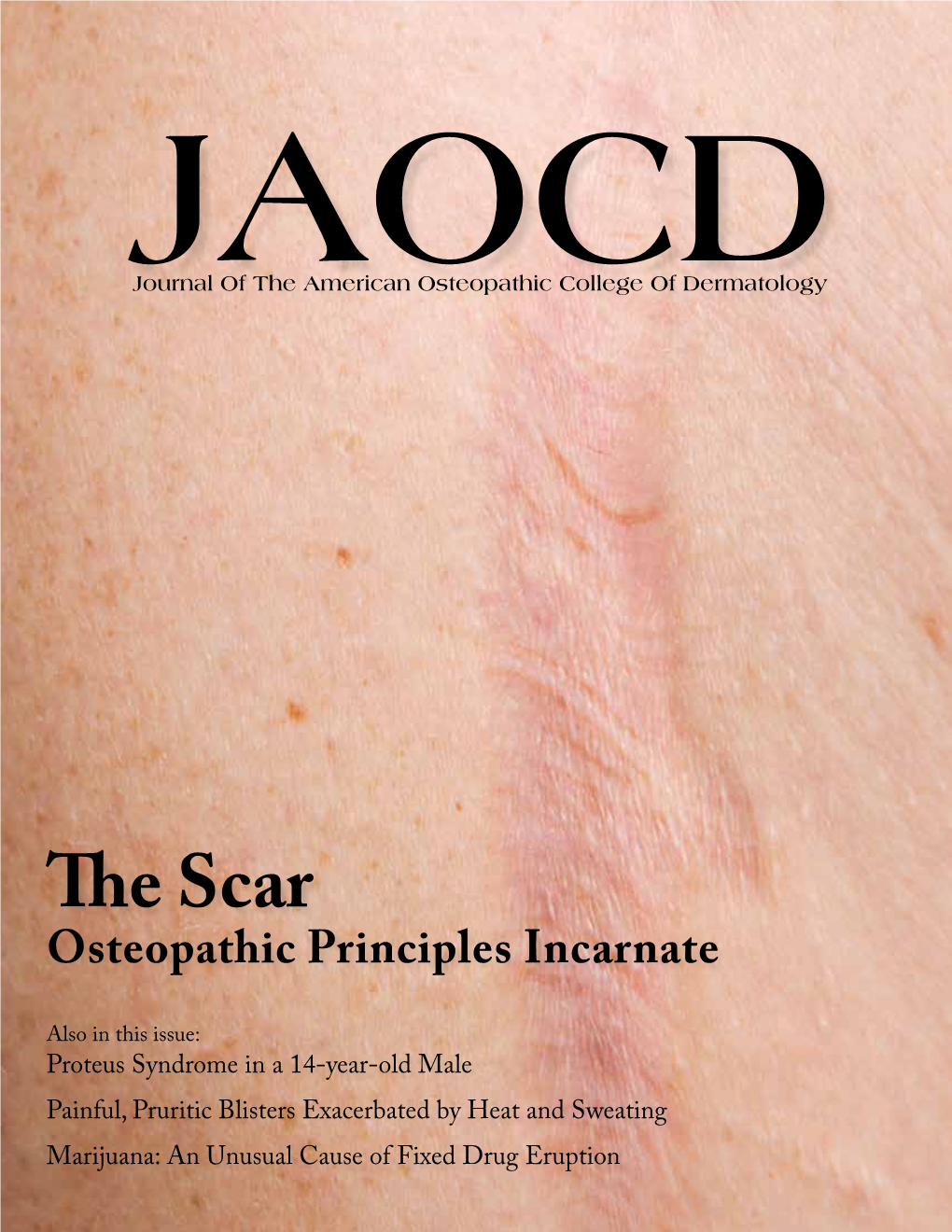 The Scar Osteopathic Principles Incarnate