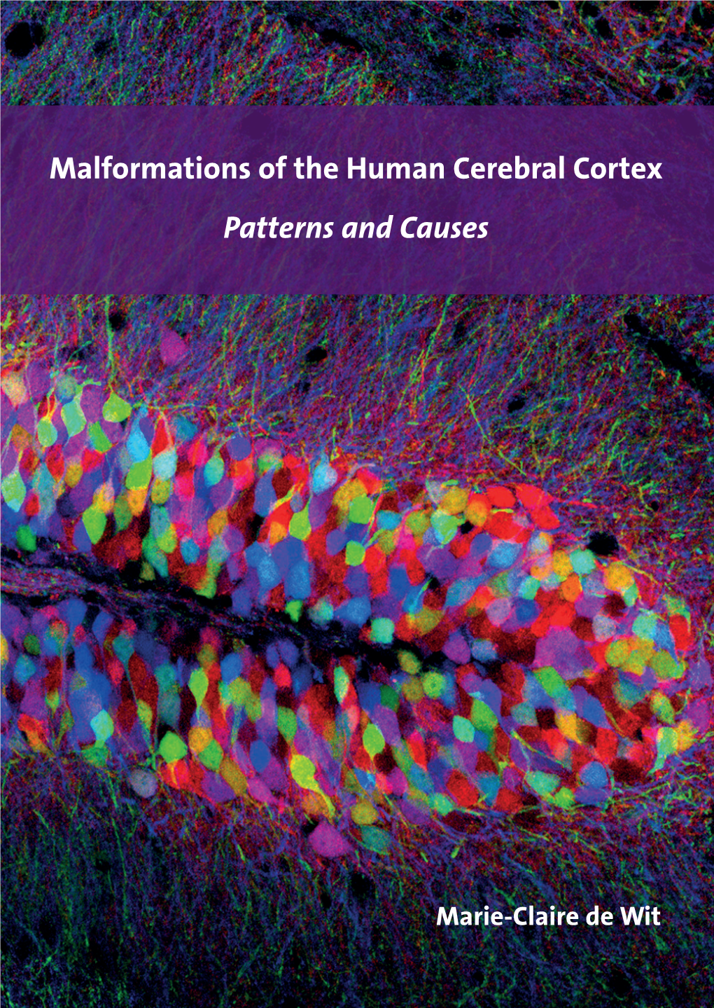 Malformations of the Human Cerebral Cortex Patterns and Causes