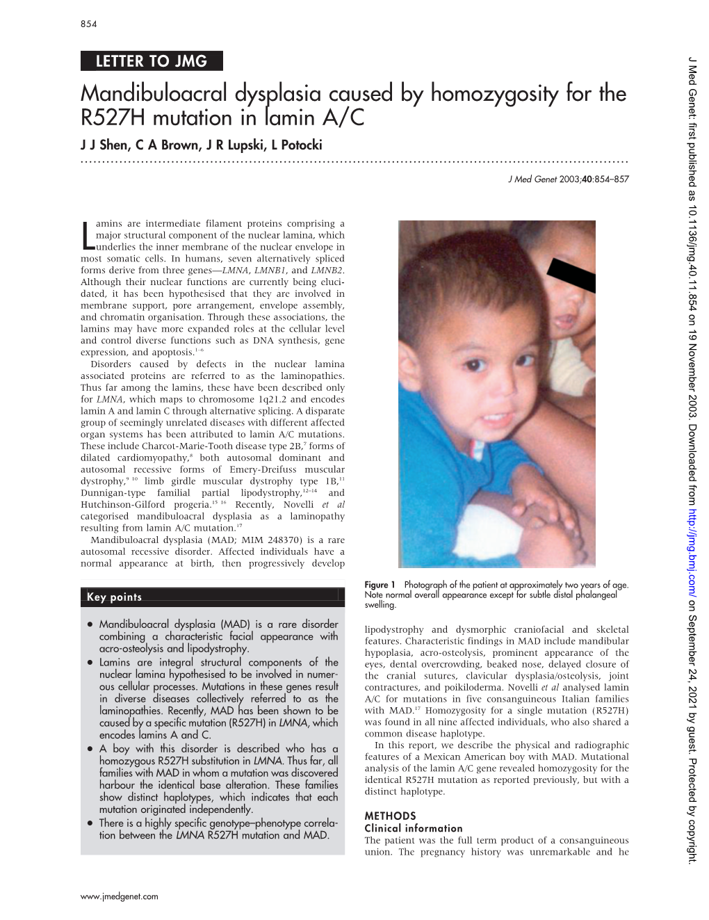 Mandibuloacral Dysplasia Caused by Homozygosity for the R527H Mutation in Lamin A/C J J Shen, C a Brown, J R Lupski, L Potocki