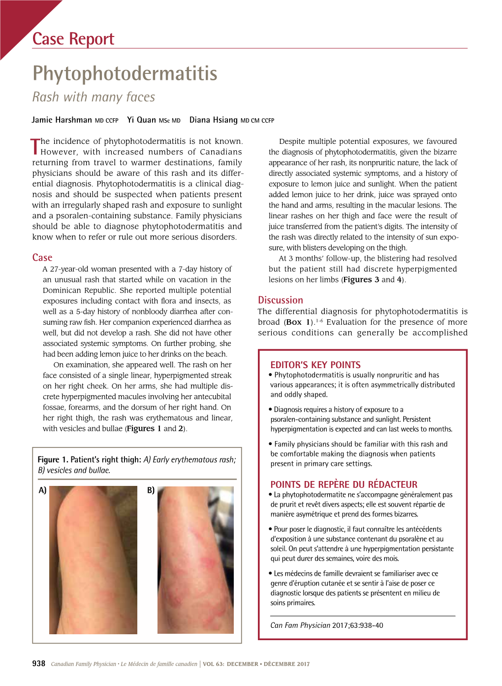 Phytophotodermatitis: Rash with Many Faces