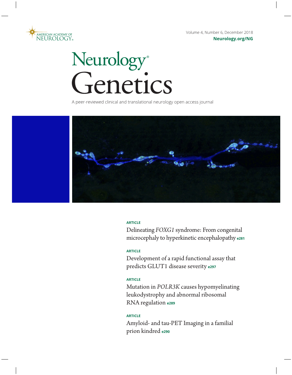 From Congenital Microcephaly to Hyperkinetic Encephalopathy E281