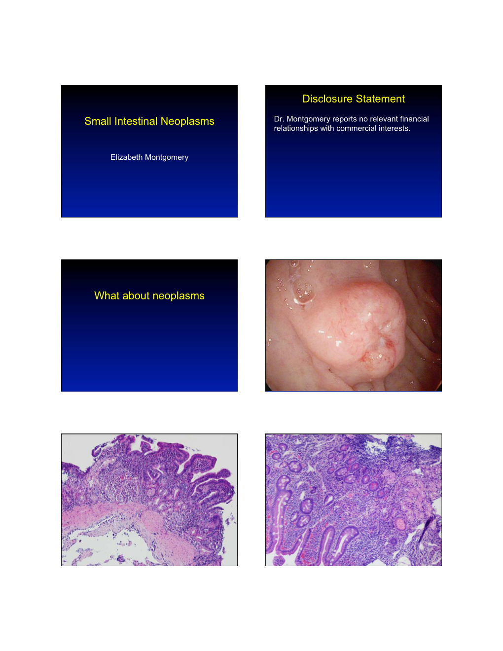 6. Montgomery.Small Bowel Neoplasms