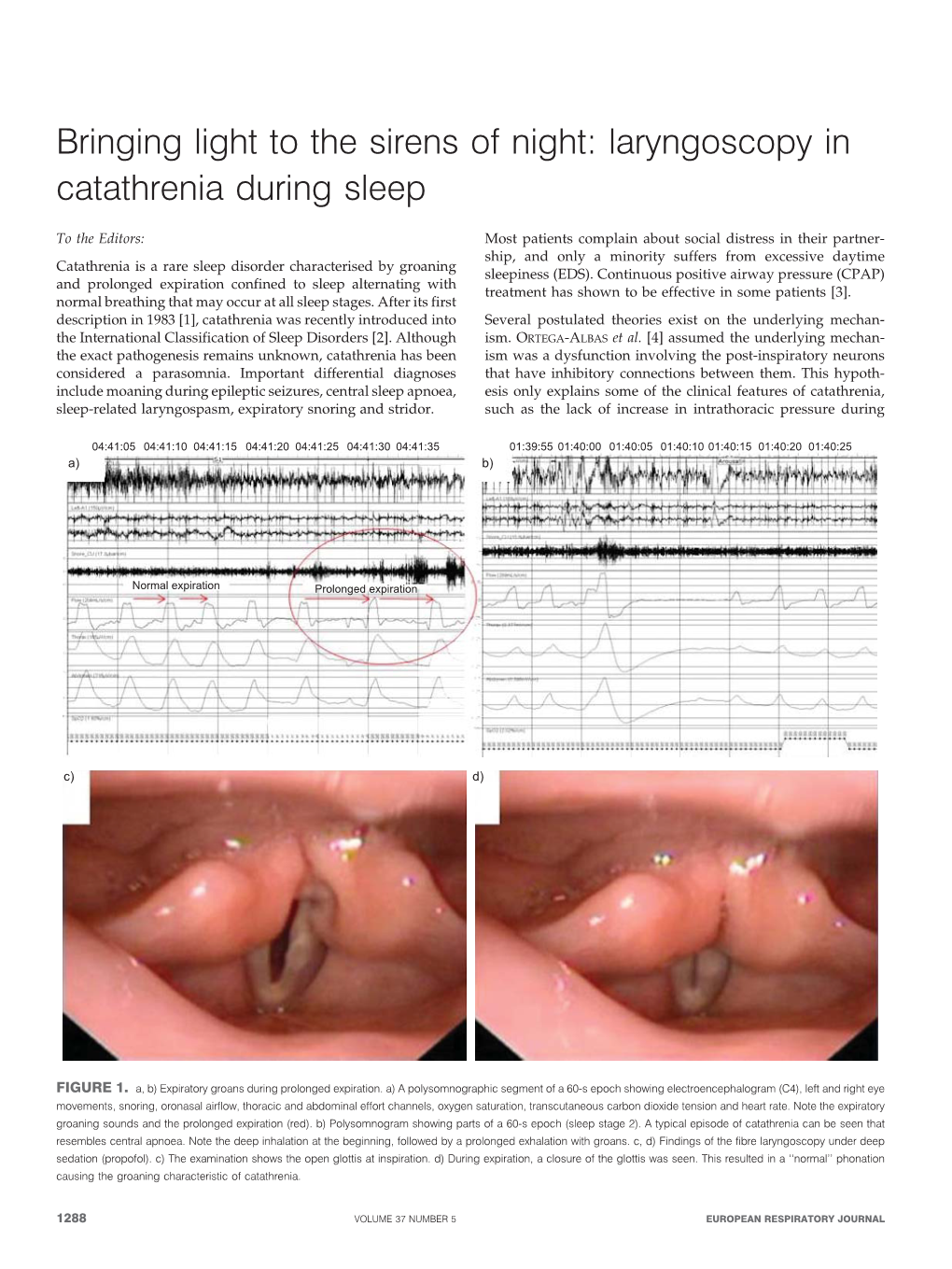 Laryngoscopy in Catathrenia During Sleep