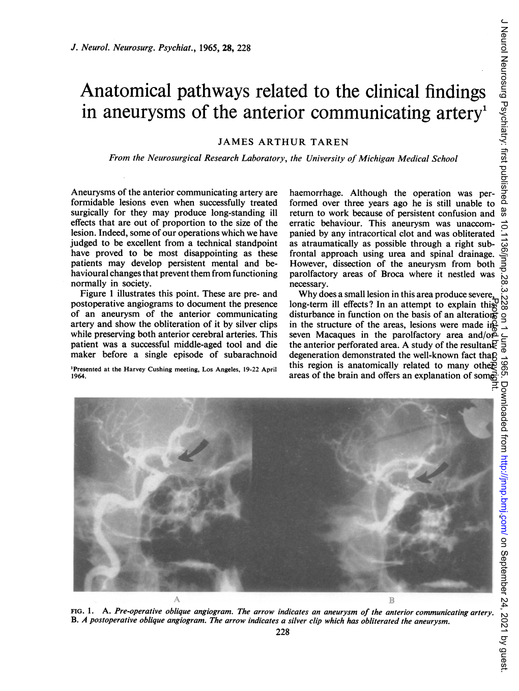 Anatomical Pathways Related to the Clinical Findings in Aneurysms of the Anterior Communicating Artery'