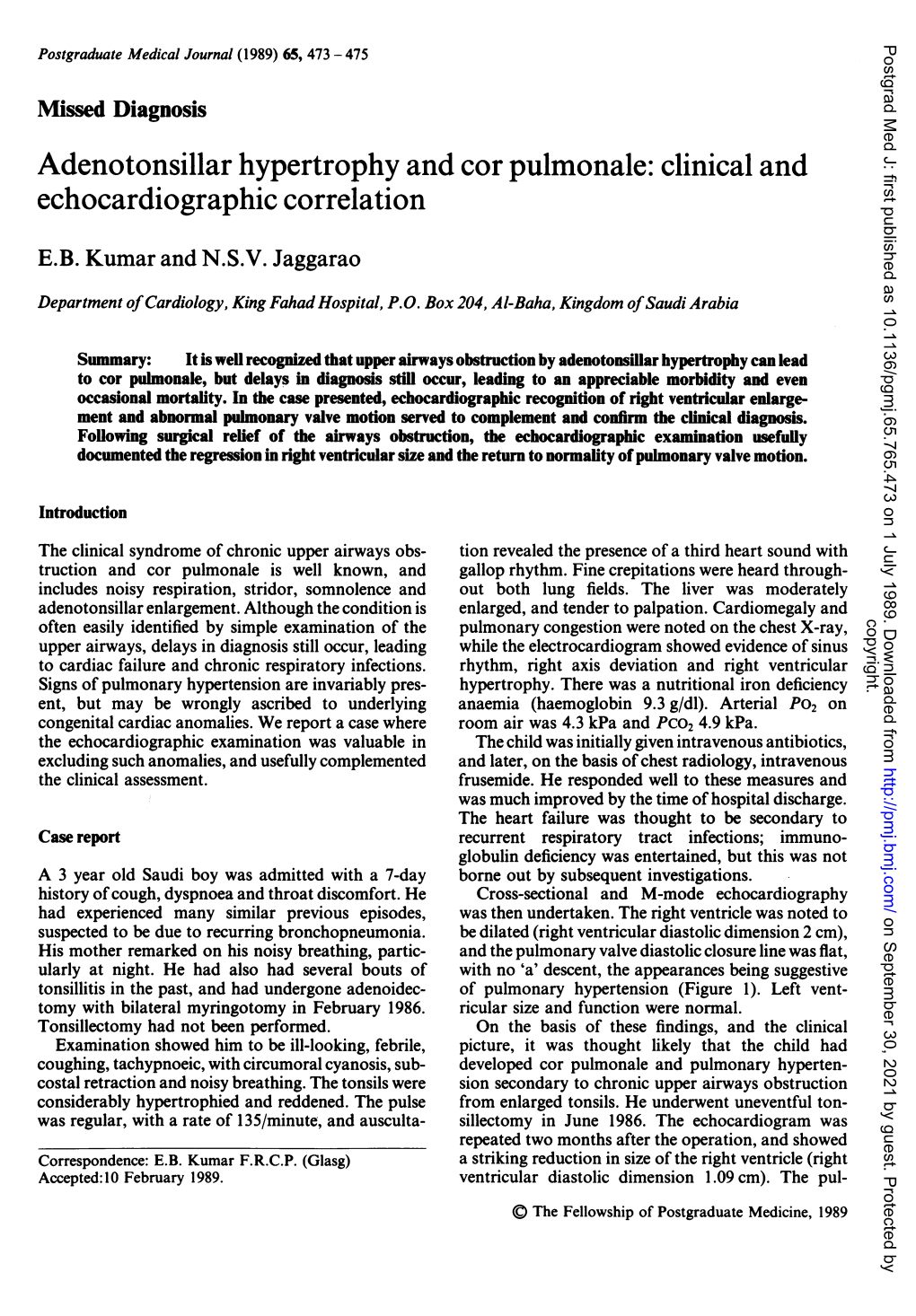 Adenotonsillar Hypertrophy and Cor Pulmonale: Clinical and Echocardiographic Correlation E.B