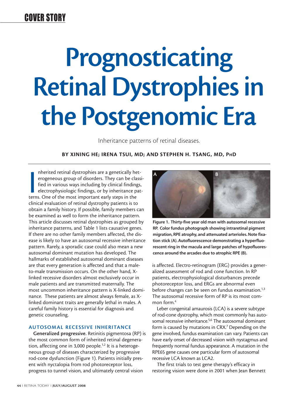 Prognosticating Retinal Dystrophies in the Postgenomic Era Inheritance Patterns of Retinal Diseases