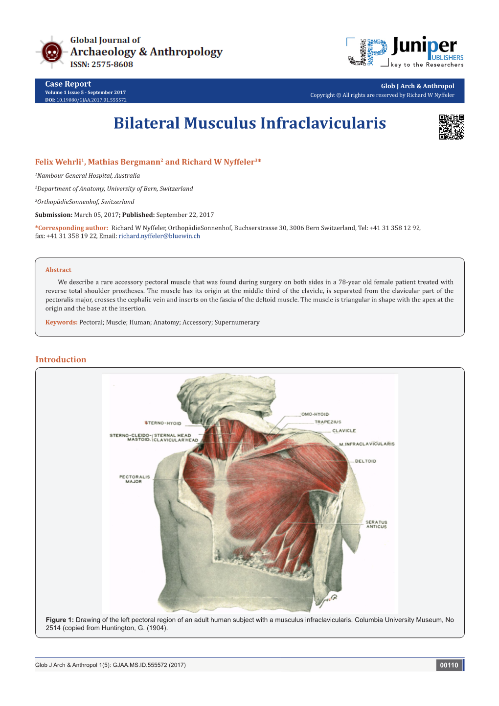 Bilateral Musculus Infraclavicularis