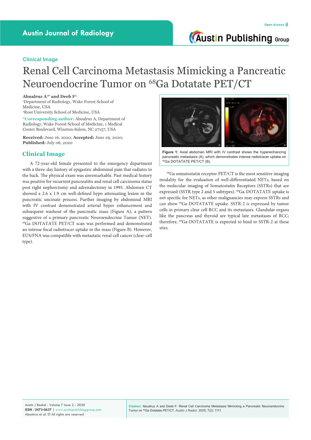 Renal Cell Carcinoma Metastasis Mimicking a Pancreatic Neuroendocrine Tumor on 68Ga Dotatate PET/CT