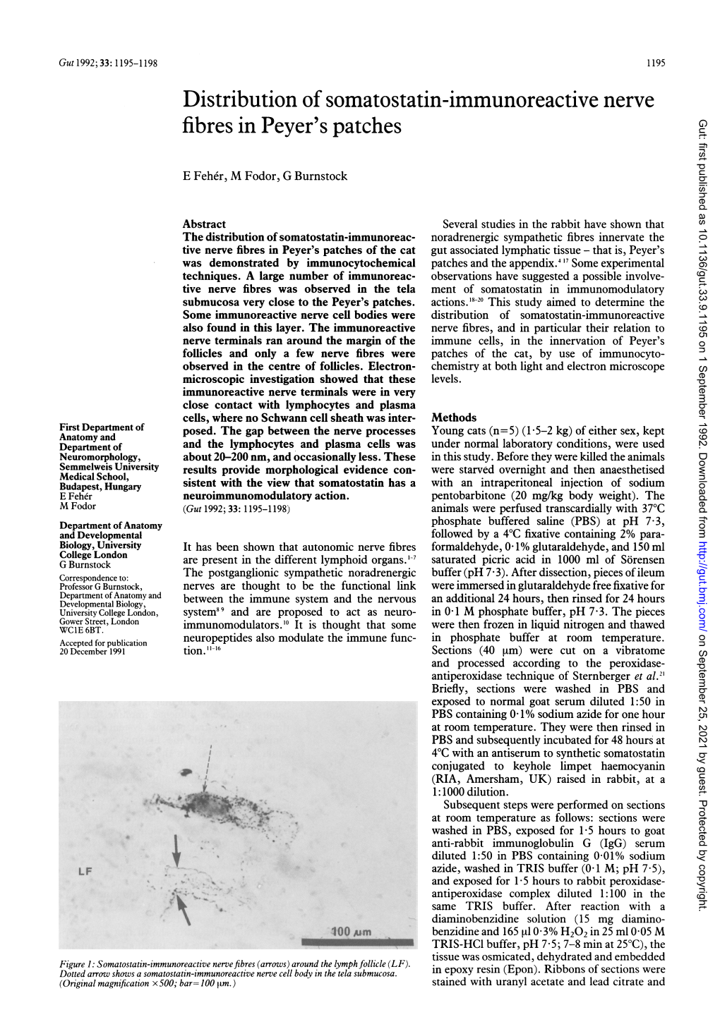 Distribution of Somatostatin-Immunoreactive Nerve Fibres in Peyer's Patches Gut: First Published As 10.1136/Gut.33.9.1195 on 1 September 1992