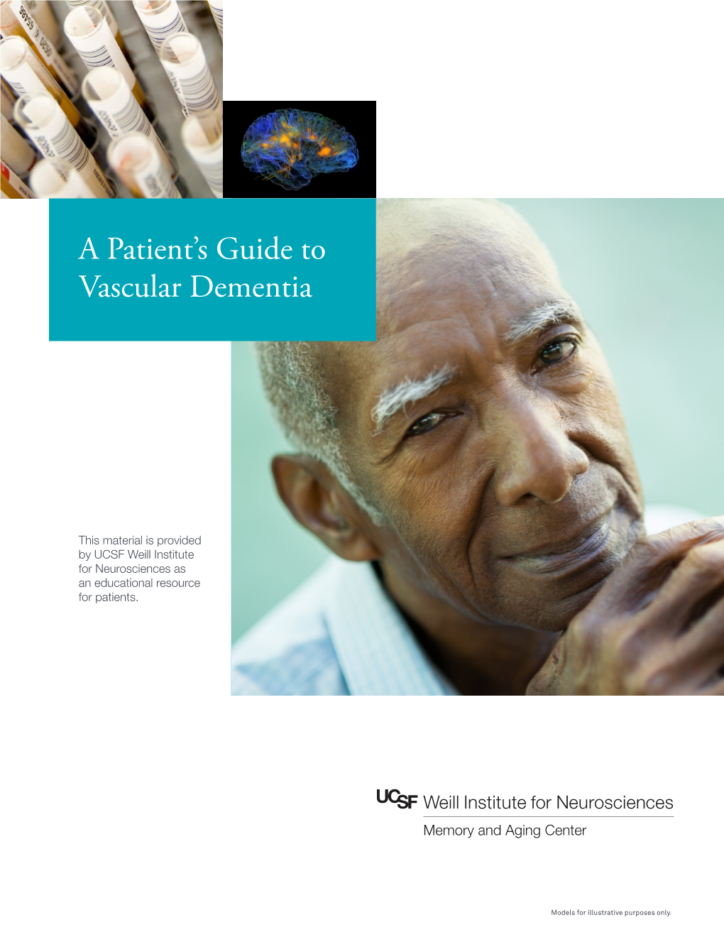 A Patient's Guide to Vascular Dementia