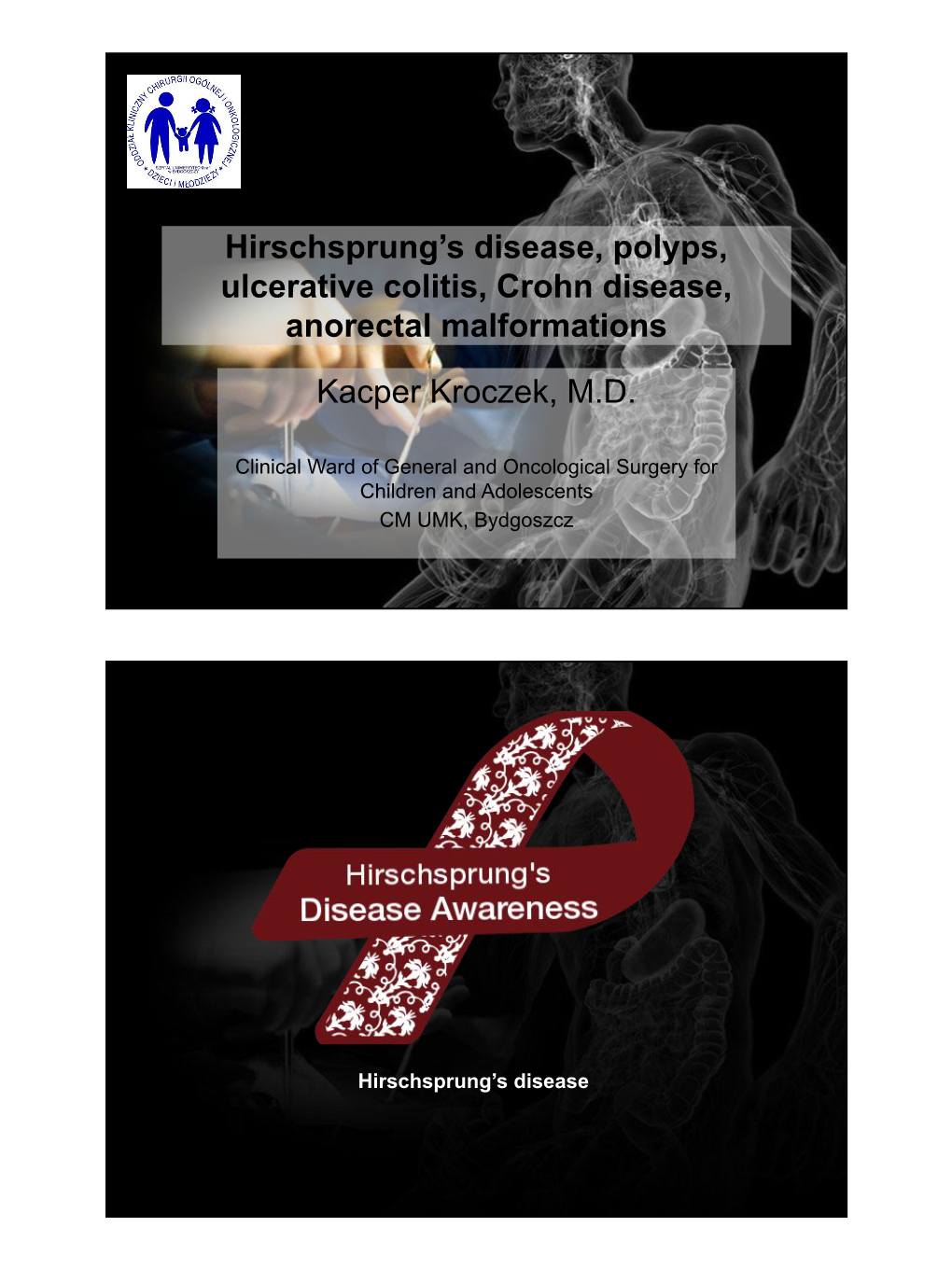 Hirschsprung's Disease, Polyps, Ulcerative Colitis, Crohn Disease