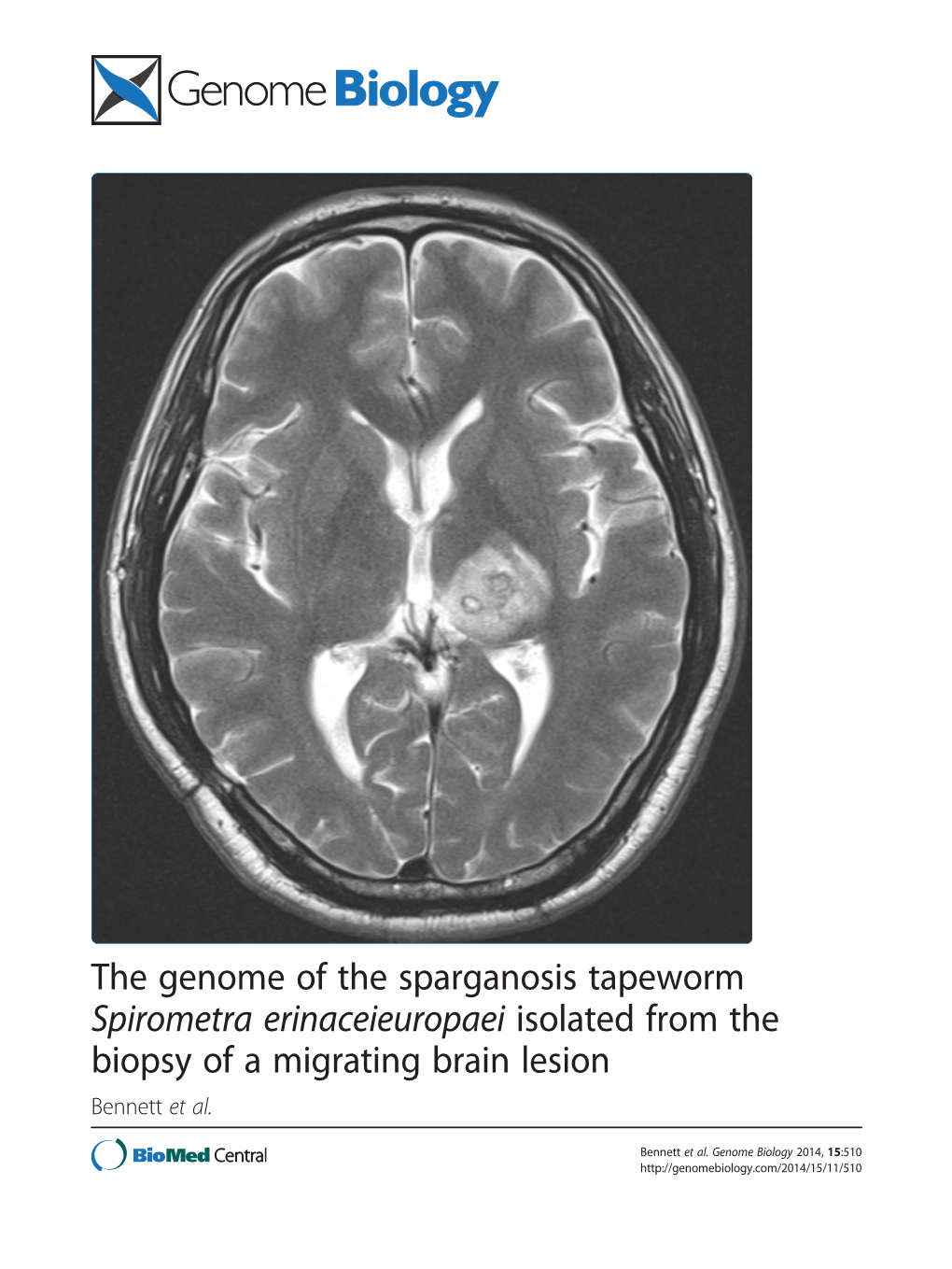 The Genome of the Sparganosis Tapeworm Spirometra Erinaceieuropaei Isolated from the Biopsy of a Migrating Brain Lesion Bennett Et Al