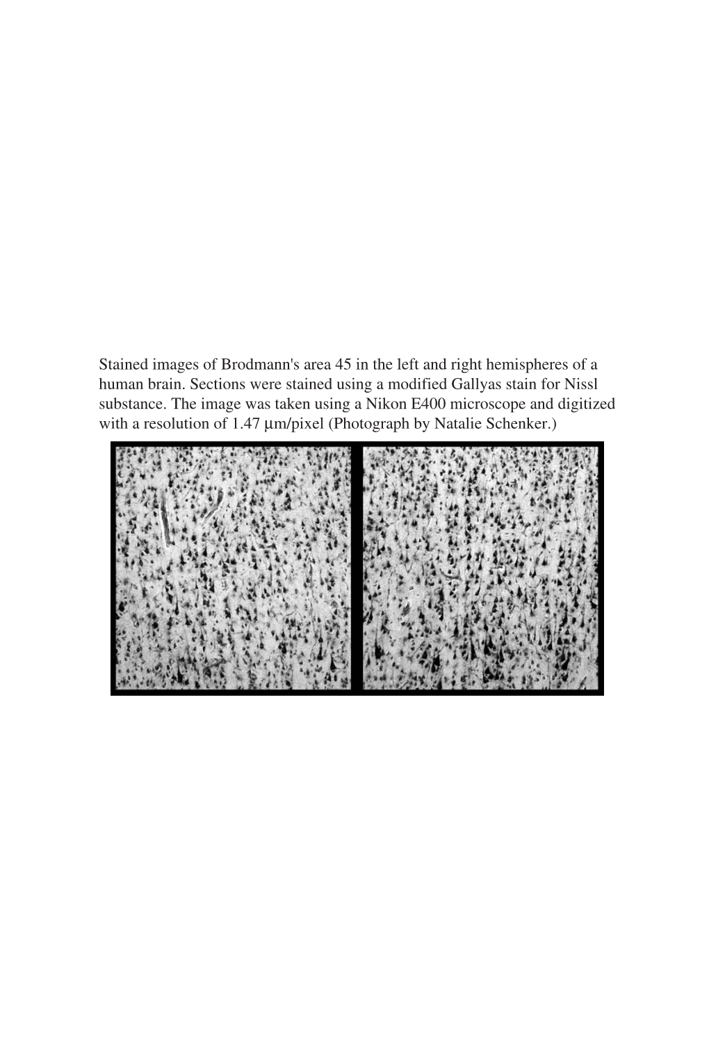 Stained Images of Brodmann's Area 45 in the Left and Right Hemispheres of a Human Brain