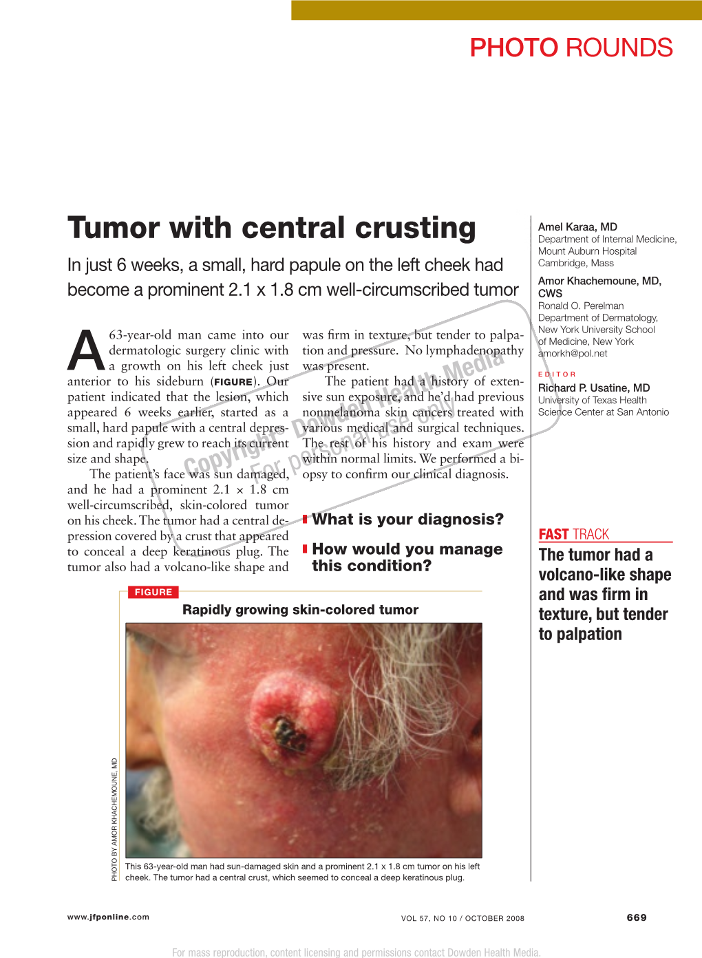 Tumor with Central Crusting Department of Internal Medicine