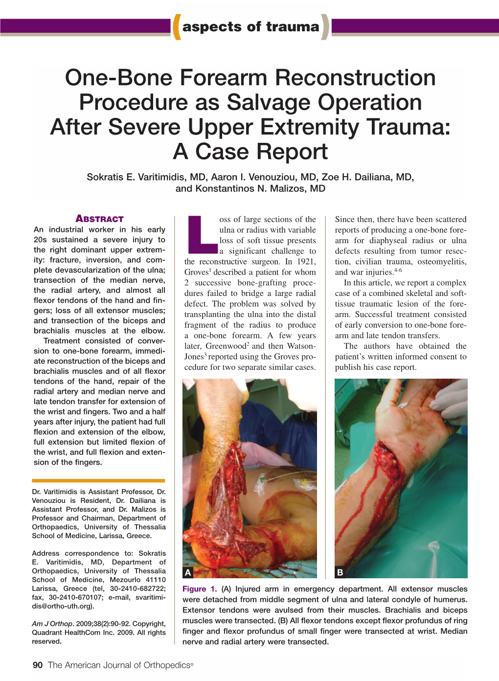 One-Bone Forearm Reconstruction Procedure As Salvage Operation After Severe Upper Extremity Trauma: a Case Report Sokratis E