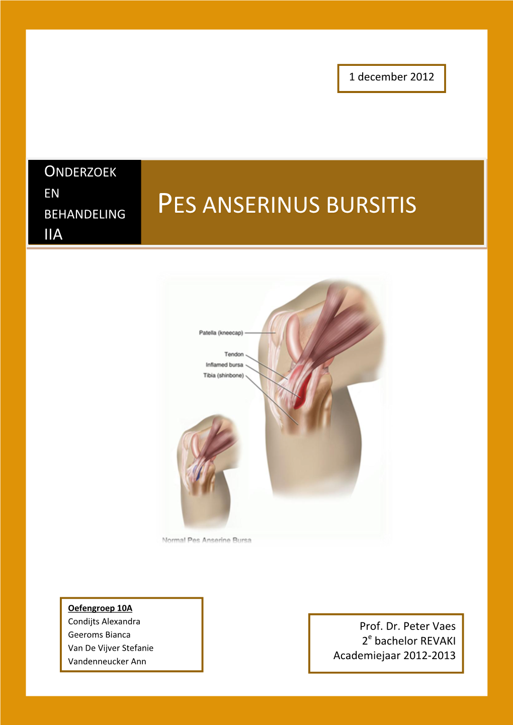 Pes Anserinus Bursitis