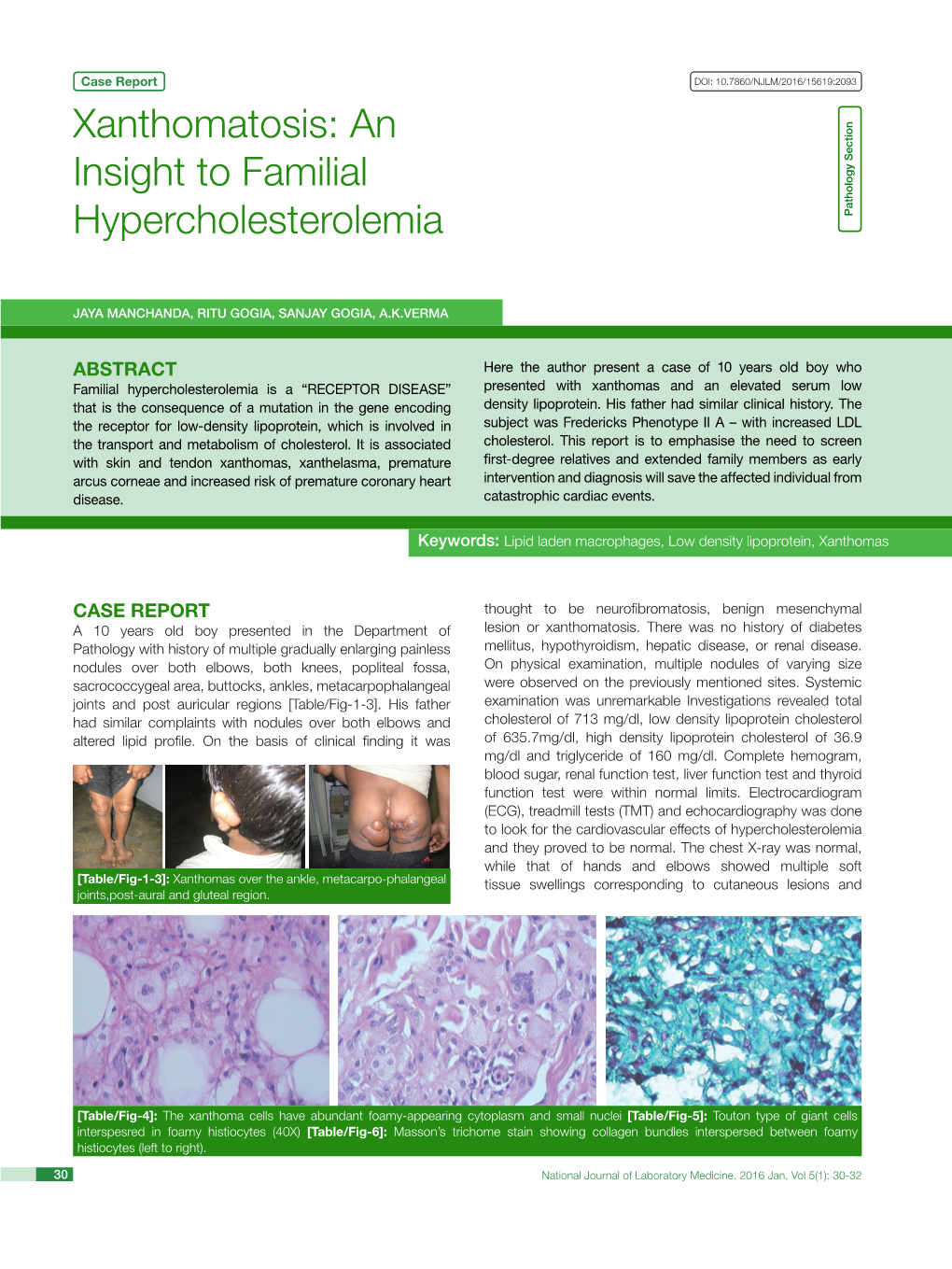 Xanthomatosis: an Insight to Familial Hypercholesterolemia Pathology Section