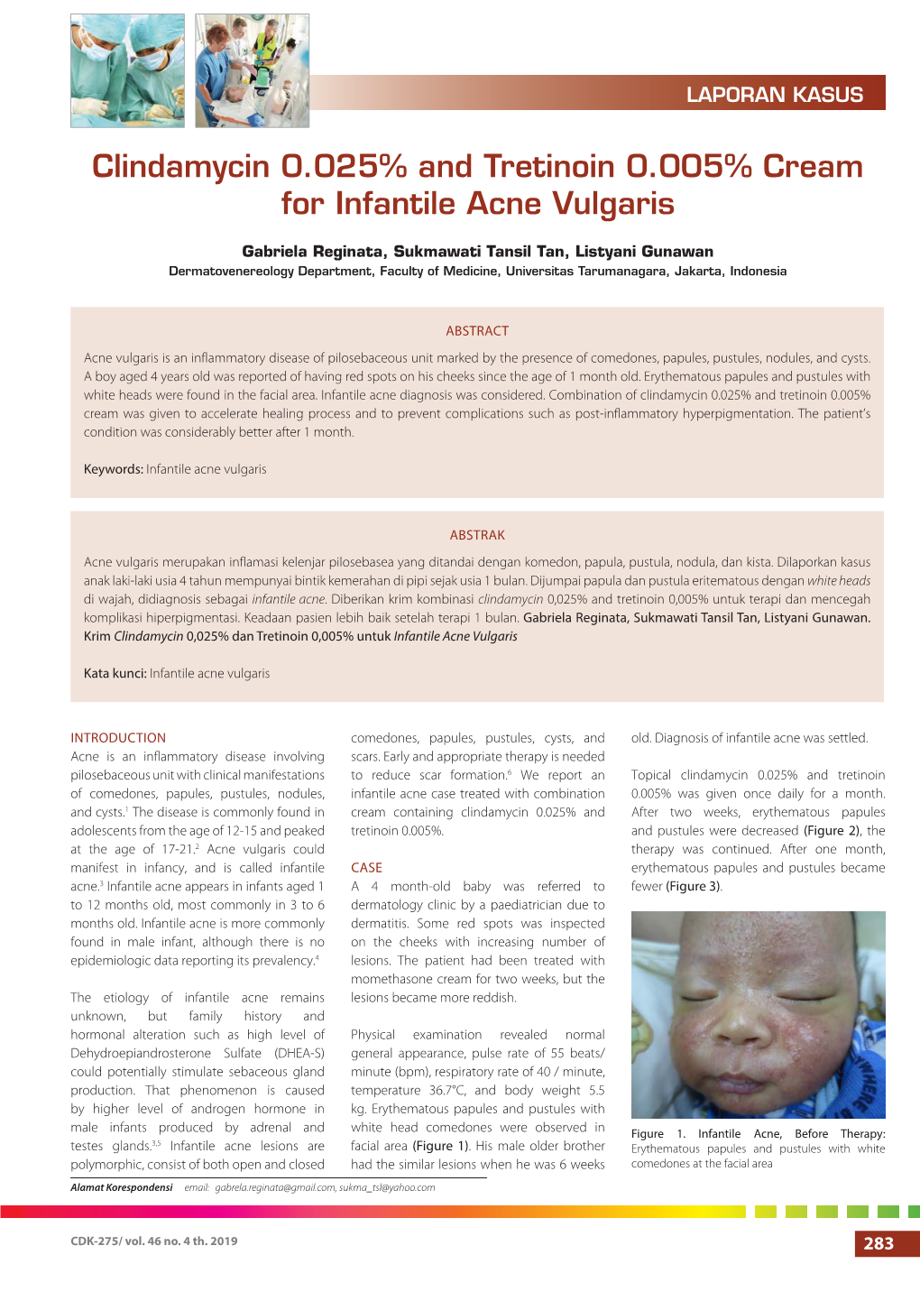 Clindamycin 0.025% and Tretinoin 0.005% Cream for Infantile Acne Vulgaris