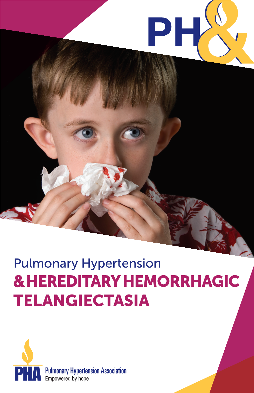&Hereditary Hemorrhagic Telangiectasia