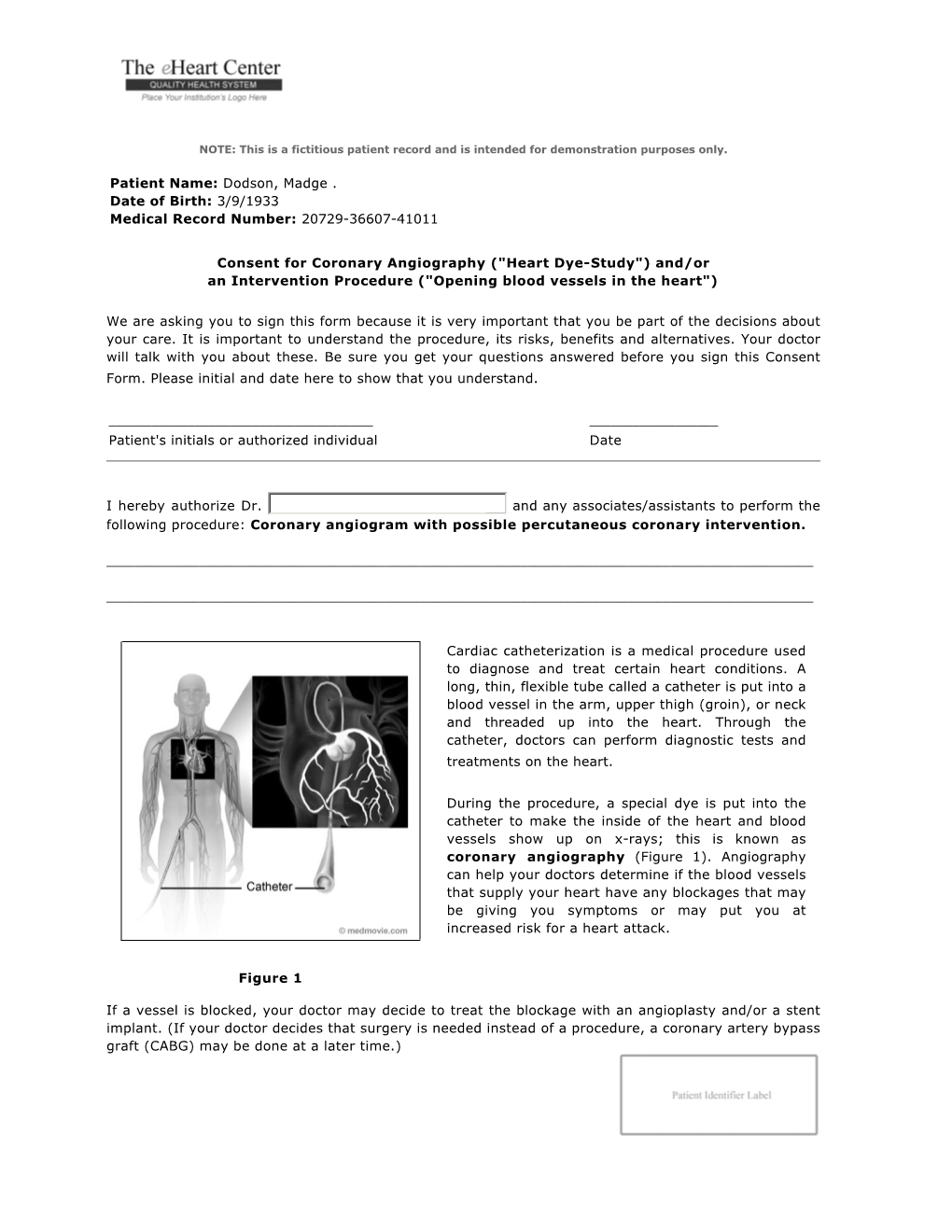 Consent for Coronary Angiography (