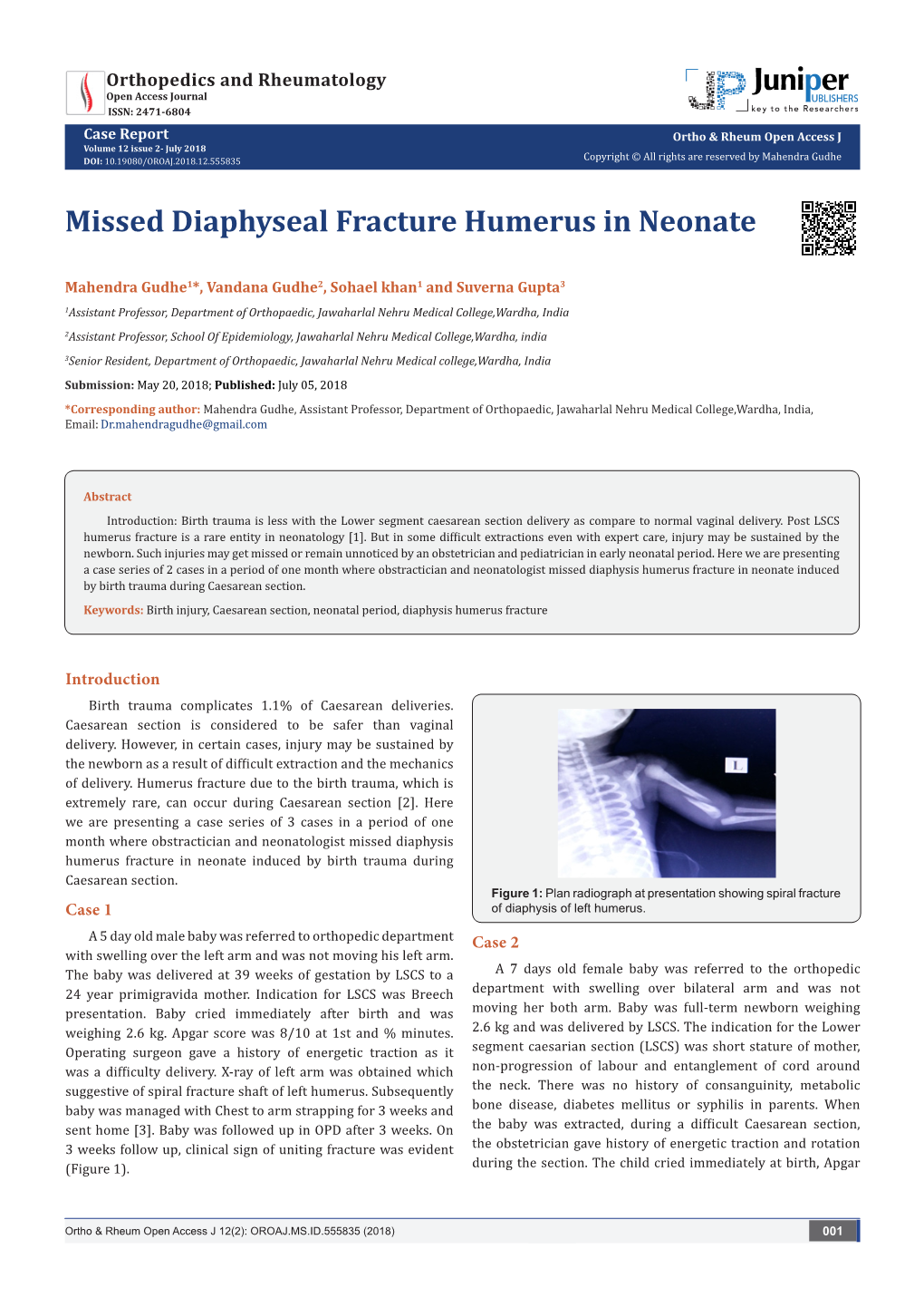 Missed Diaphyseal Fracture Humerus in Neonate