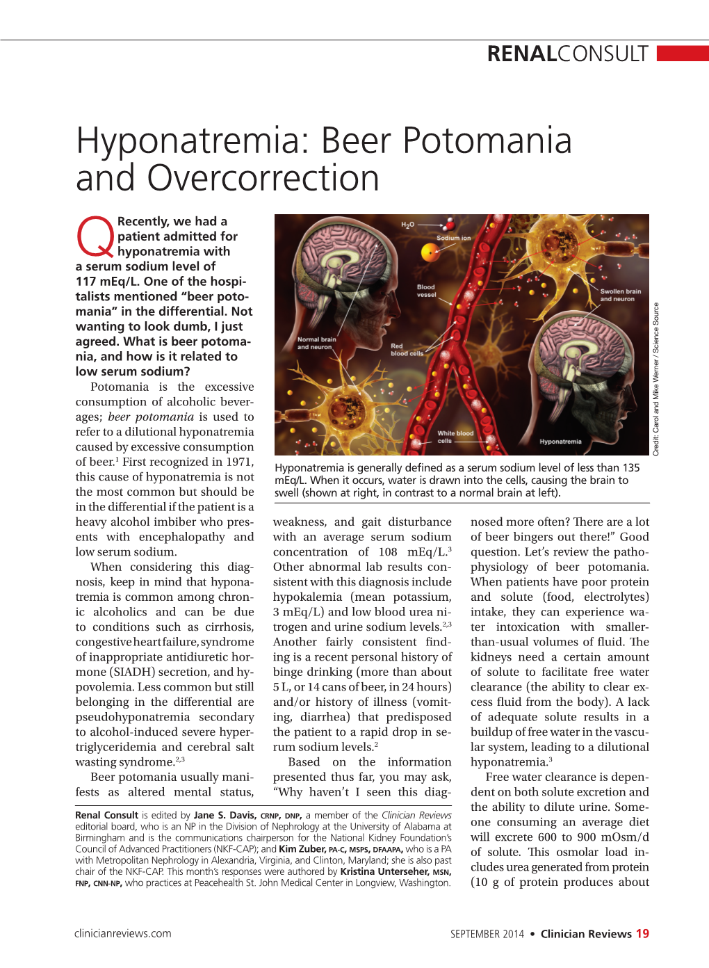 Hyponatremia: Beer Potomania and Overcorrection