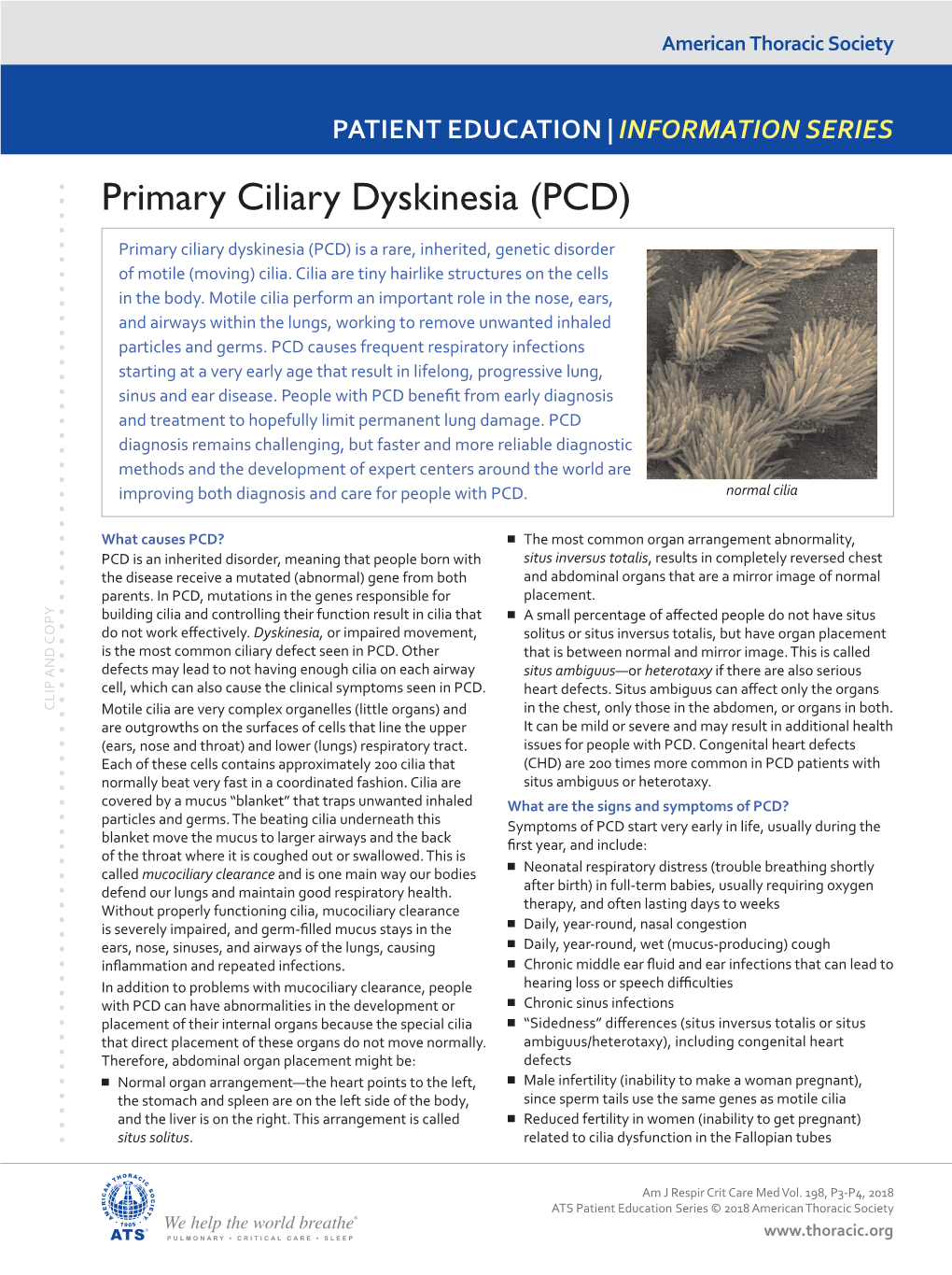 Primary Ciliary Dyskinesia (PCD)