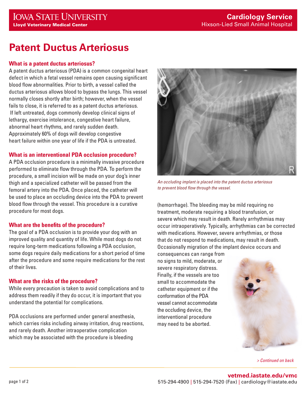 Patent Ductus Arteriosus (PDA) Is a Common Congenital Heart Defect in Which a Fetal Vessel Remains Open Causing Significant Blood Flow Abnormalities