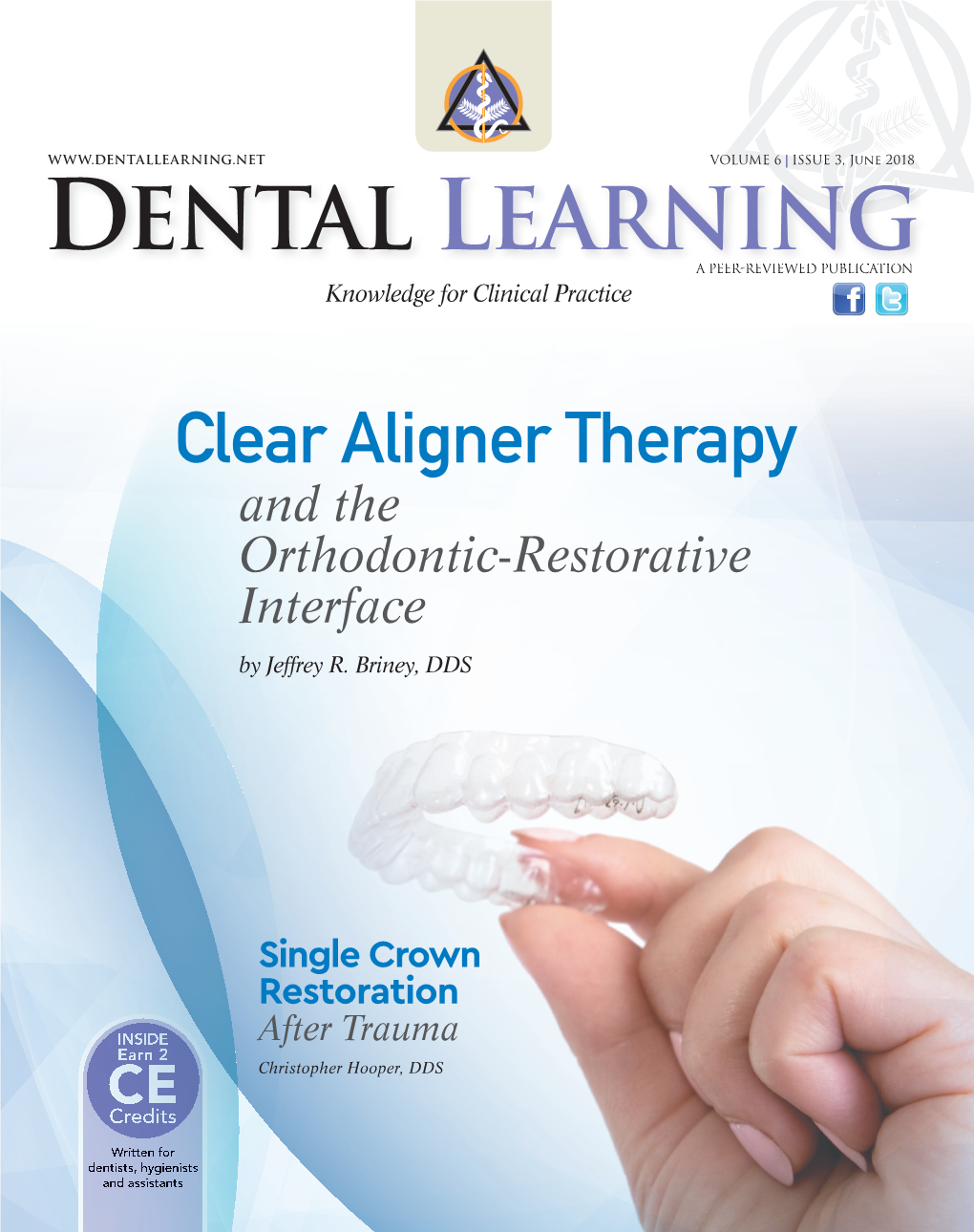 Clearaligner-Therapy and the Orthodontic-Restorative Interface