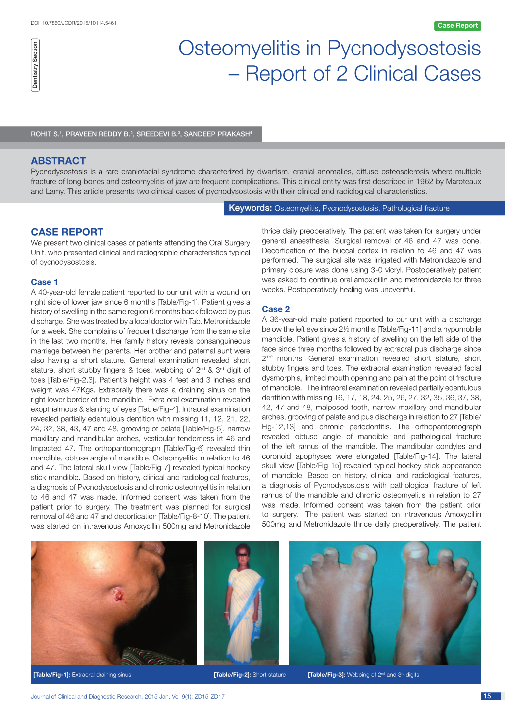 Osteomyelitis in Pycnodysostosis – Report of 2 Clinical Cases Dentistry Section