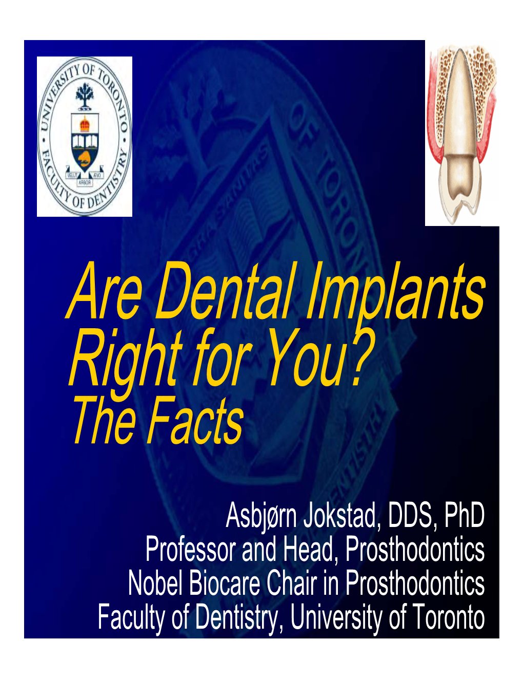 Are Implants Right for You?
