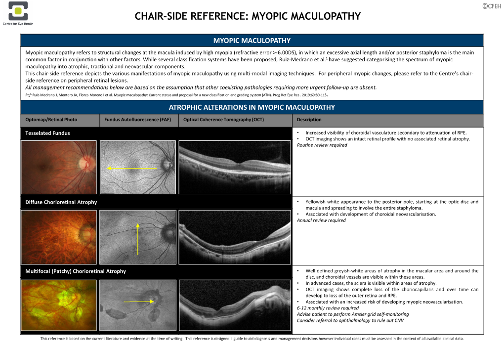 Chair-Side Reference: Myopic Maculopathy